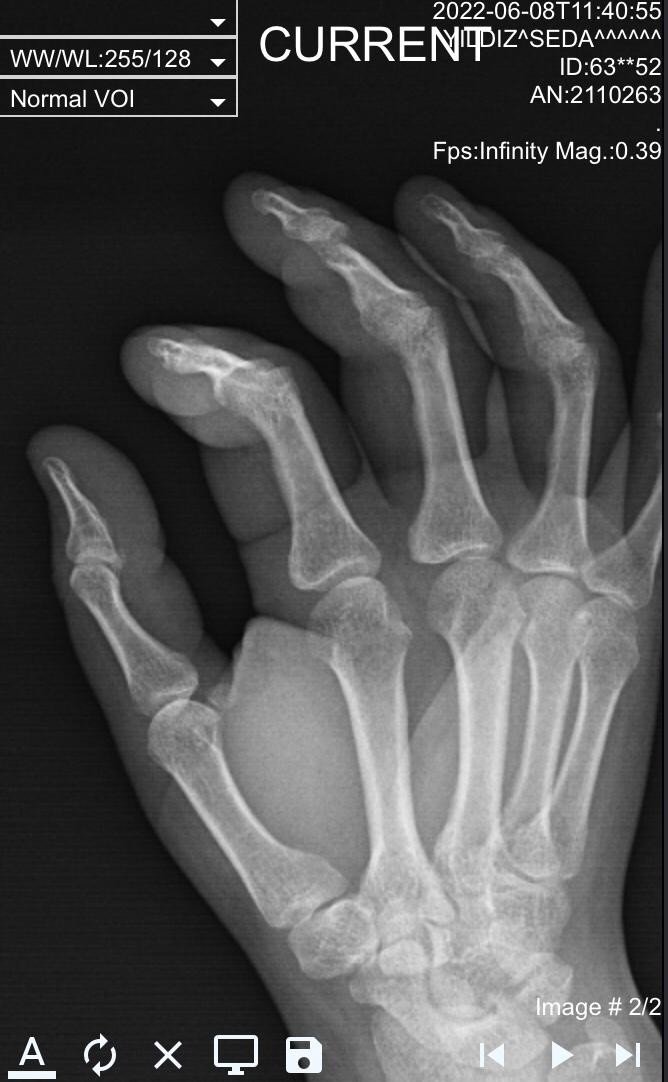 Komşu Kavgasını Ayırayım Derken Başına Gelmeyen Kalmadı