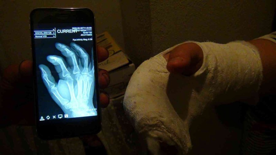 Komşu Kavgasını Ayırayım Derken Başına Gelmeyen Kalmadı