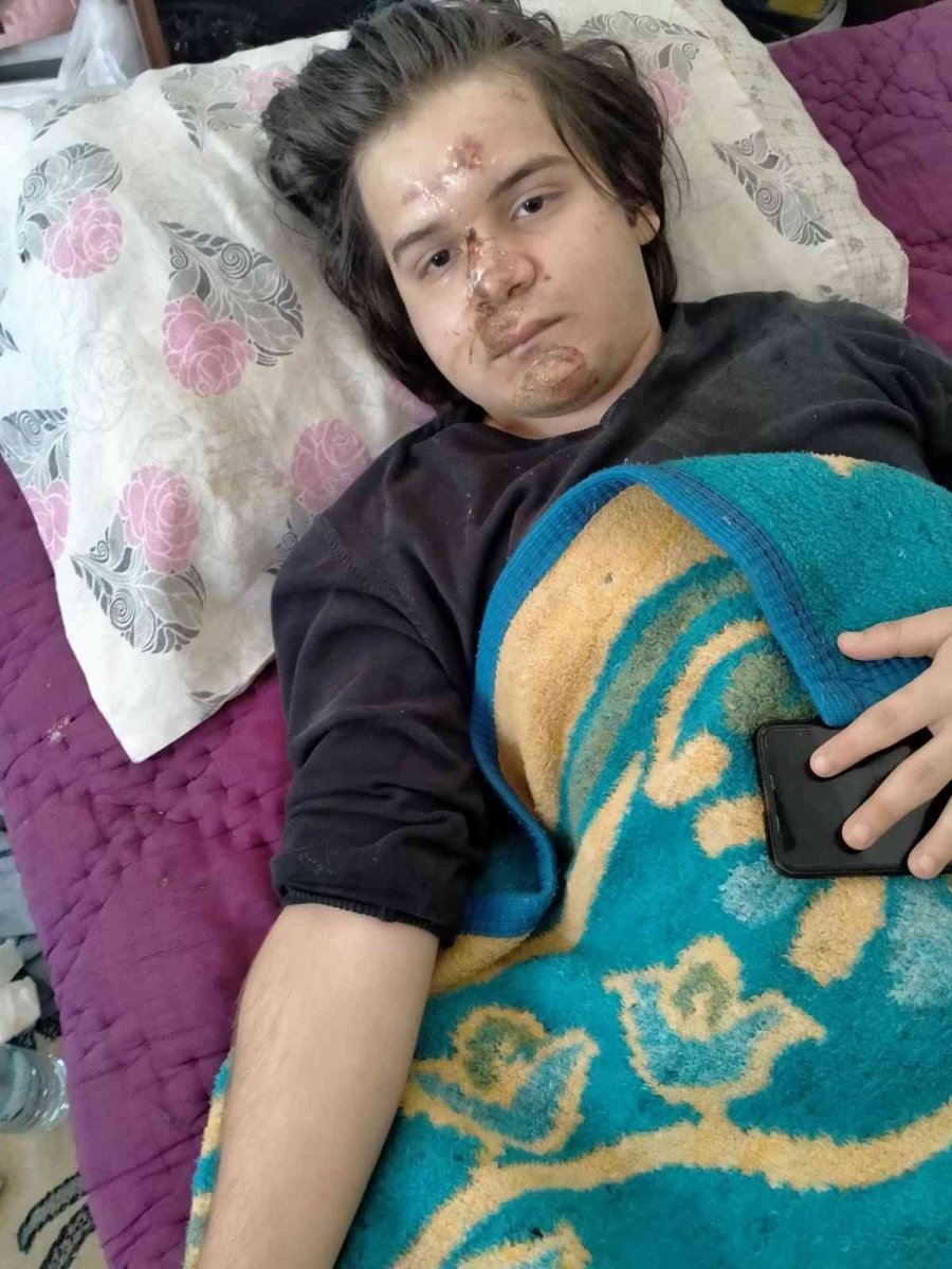 Antalya’da Ters Yönden Yola Çıkan Ticari Taksi Motosiklet Sürücüsünün Ölümle Burun Buruna Getiedi