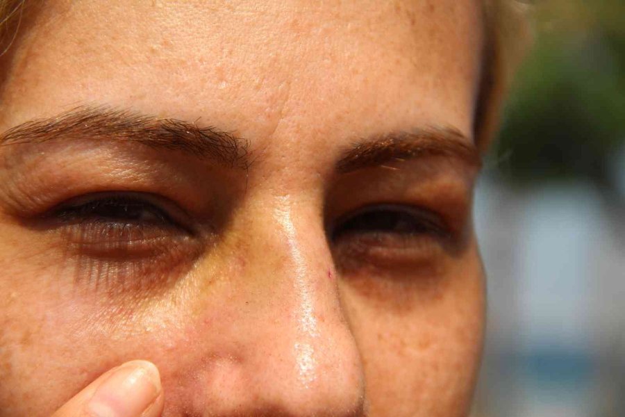 Salıncağa Binen İki Genç Kız, ’çakmak’ İsteyen Şahsa Olmadığını Söyleyince Darp Edildi