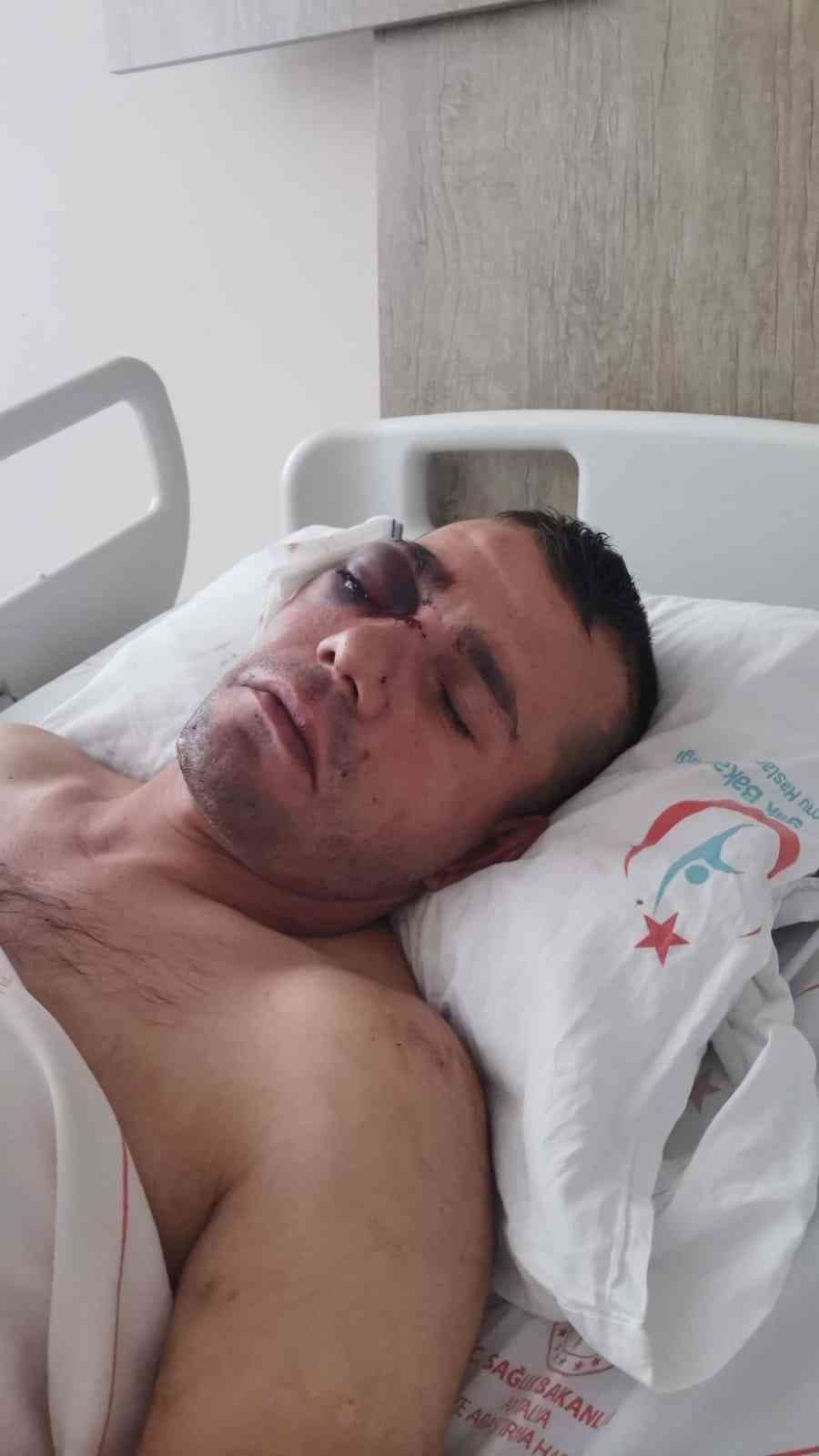 Yüzde 40 Engelli Adamı Öldüresiye Dövüp Gözünden Ettiler