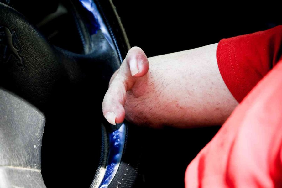 Doğuştan Elleri Olmayan Esnafın Yaptıklarını Görenler Hayrete Düşüyor