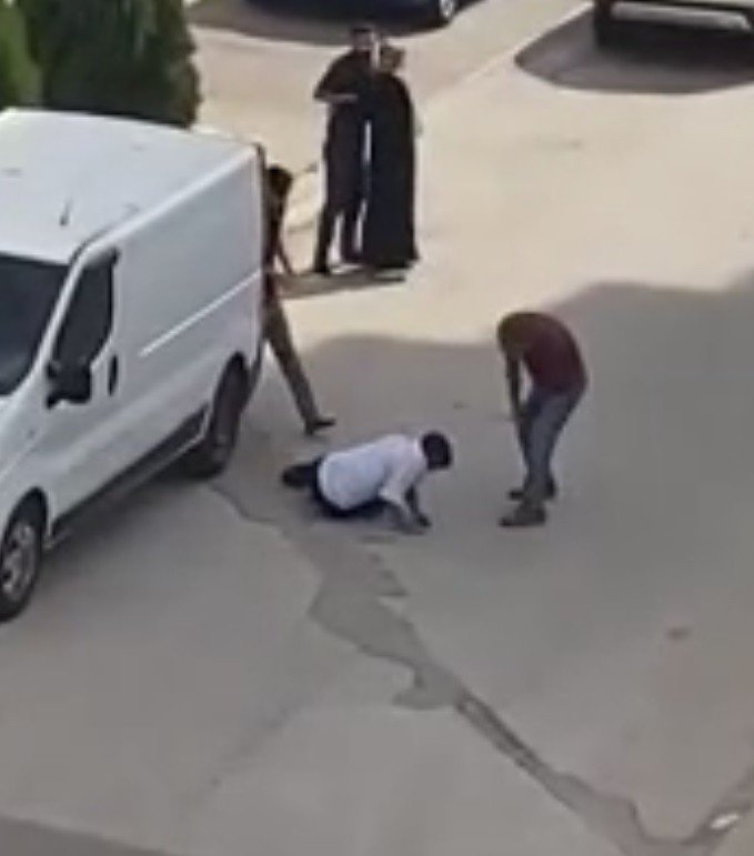 Sokak Ortasında Kafasında Sopa Kırıldı, O Anlar Kamerada