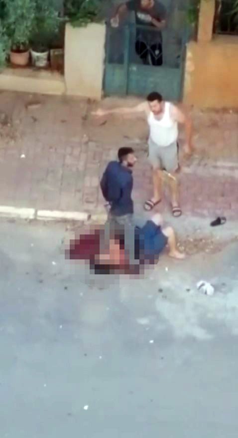 Sokak Ortasında Bıçakladığı Kadının Başında Bekleyip Yanına Kimseyi Yaklaştırmadı