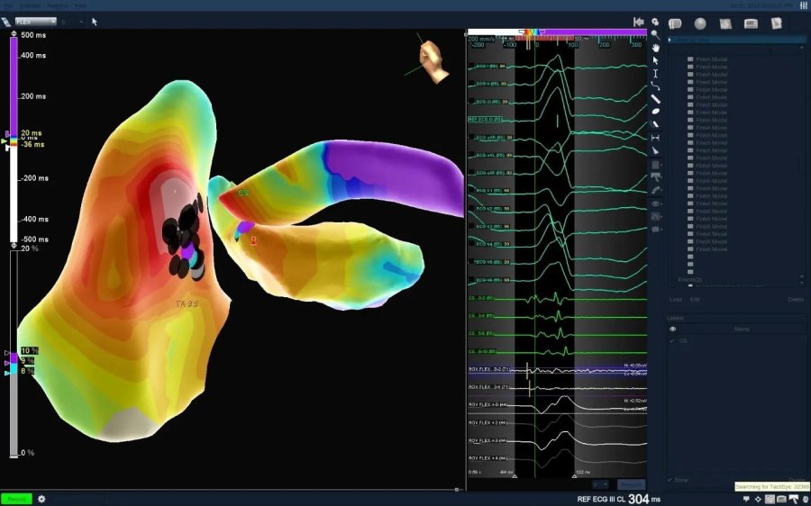 70 Yaşındaki Hasta Bu Yöntemle Sağlığına Kavuştu