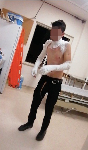 Adresi Yanlış Verdiği Ambulansın Geç Geldiğini İddia Edip, Kendini Yakmaya Çalıştı