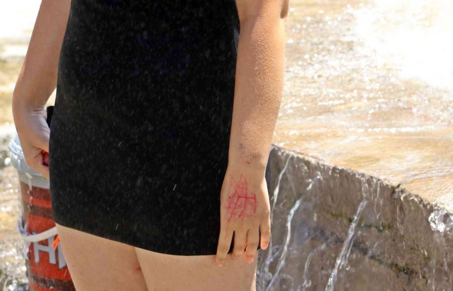 Süs Havuzu Başında Elini Kalemle Kırmızıya Boyayan Genç Kız, Polisi Alarma Geçirdi