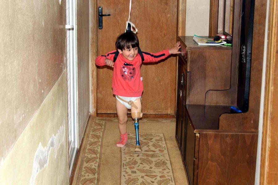 Koşmayı Beklerken Dar Gelen Proteziyle Yürümekte Zorlanıyor