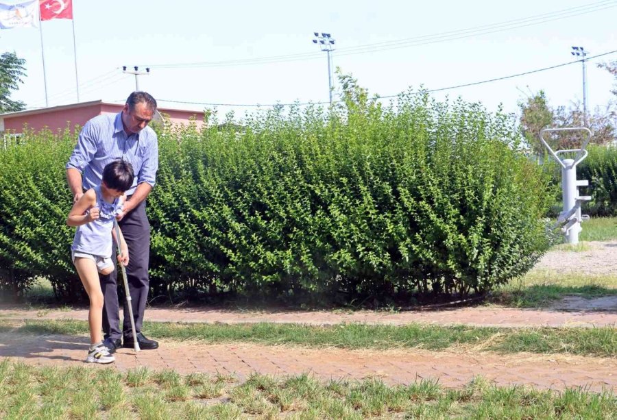 Koşmayı Beklerken Dar Gelen Proteziyle Yürümekte Zorlanıyor
