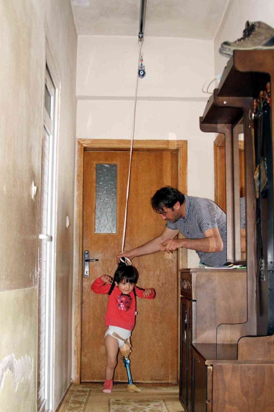 Koşmayı Beklerken Dar Gelen Proteziyle Yürümekte Zorlanıyor