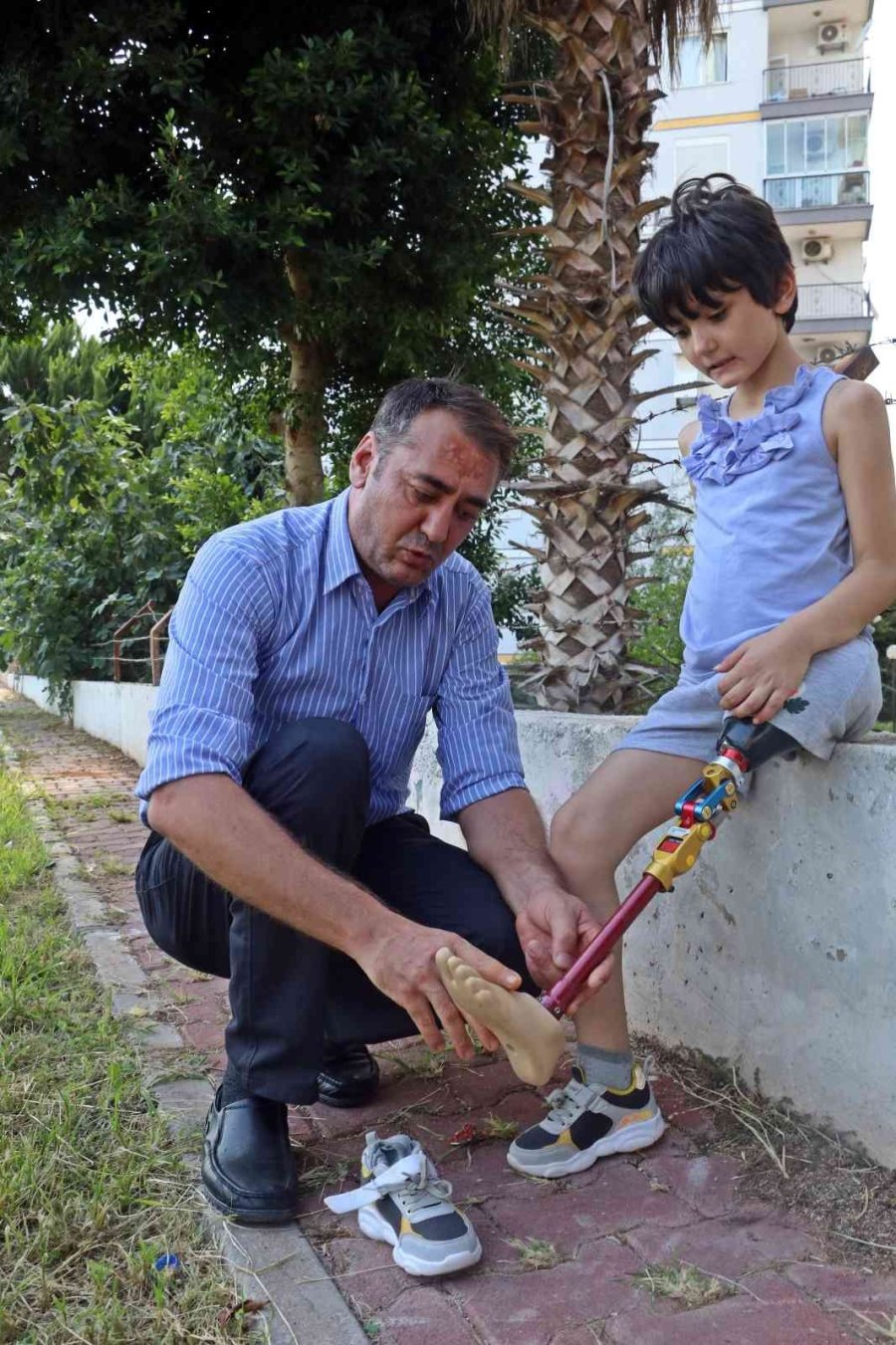 Koşmayı Beklerken Dar Gelen Proteziyle Yürümekte Zorlanıyor