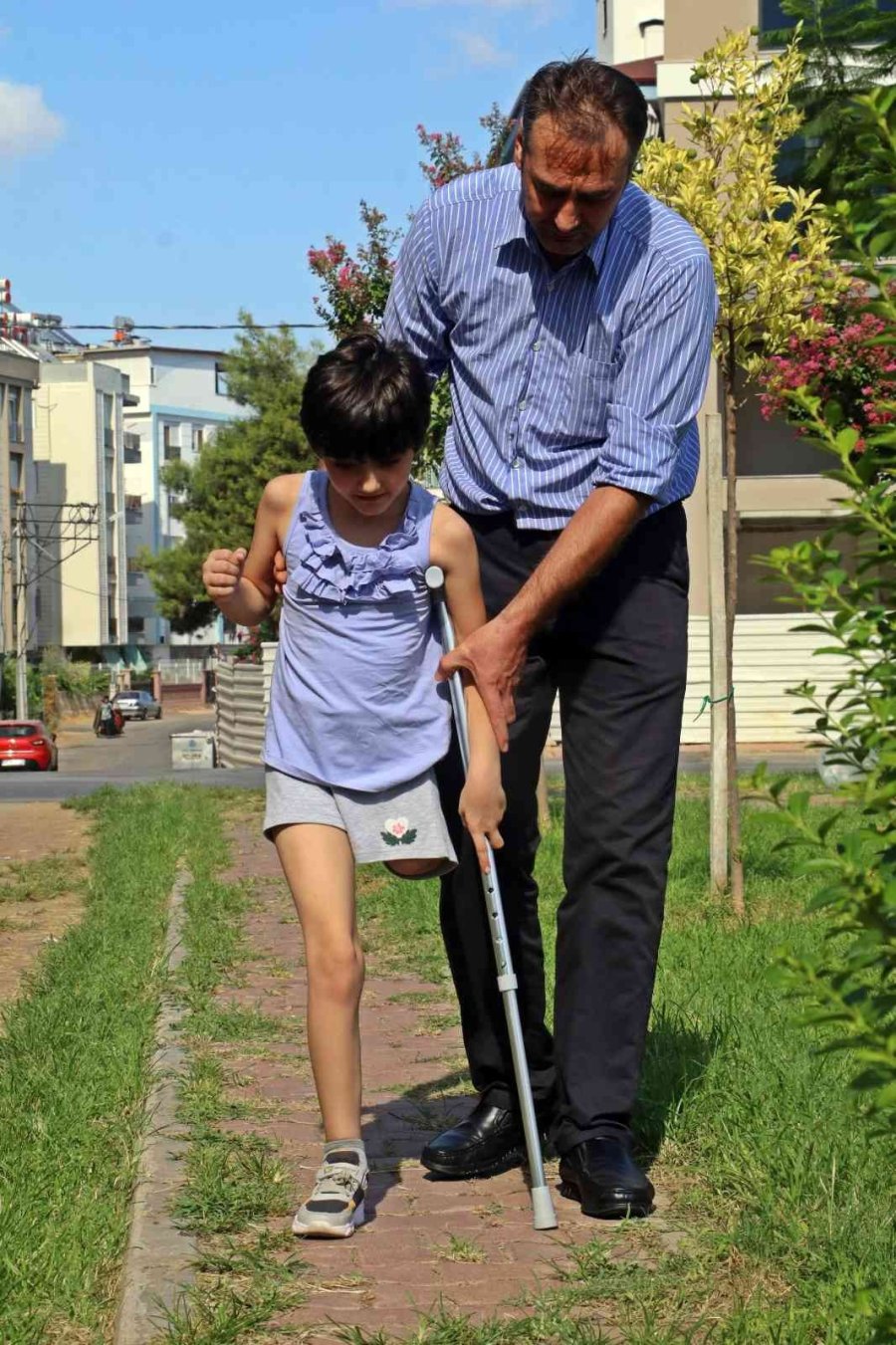 Koşmayı Beklerken Dar Gelen Proteziyle Yürümekte Zorlanıyor