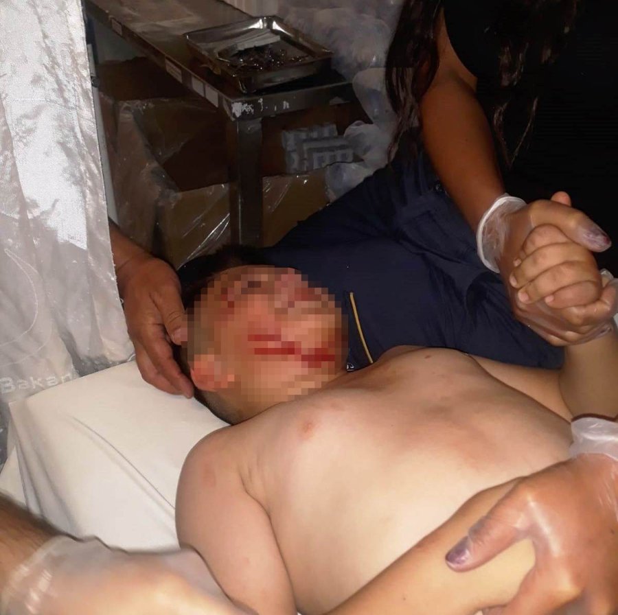 Köpeğin Saldırdığı Çocuk Hastanelik Oldu