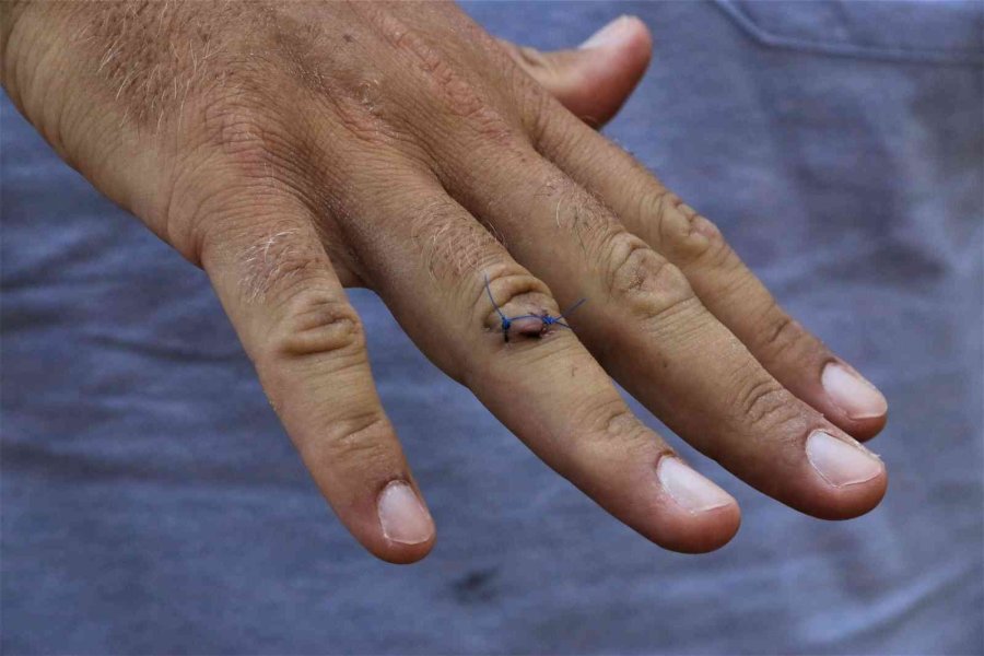 Çalınan Köpeğini Kurtarmak İsterken Bıçaklanıp Ölümden Döndü