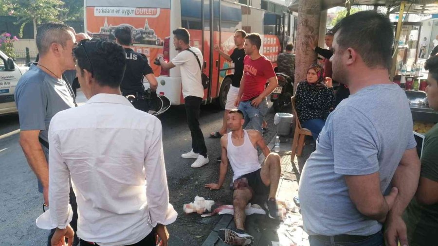 Dövme Yaptırmak İçin Gittiği Dükkanda Önce Dövüldü Sonra Bıçaklandı