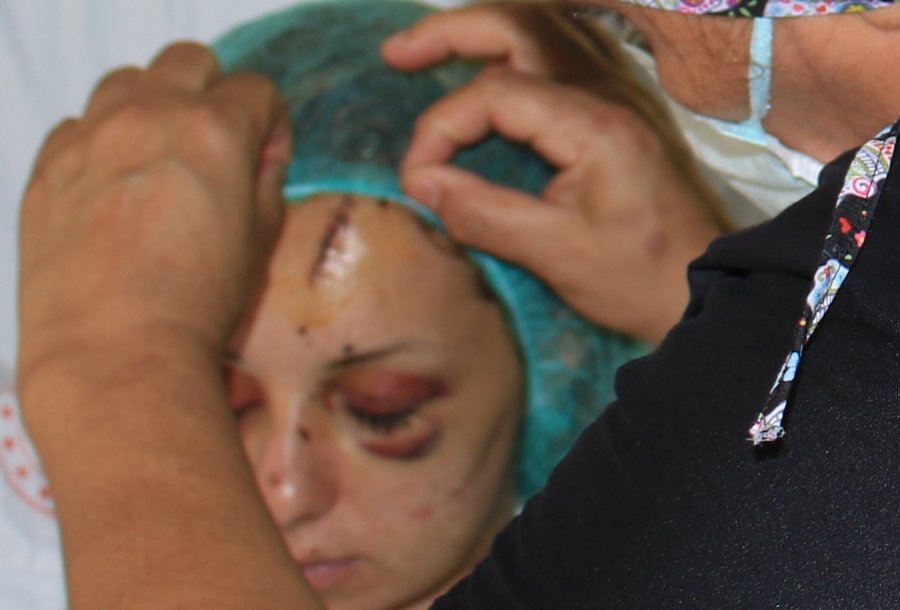 Yoğun Bakımdan Çıkan Kadın, O Anları Anlattı