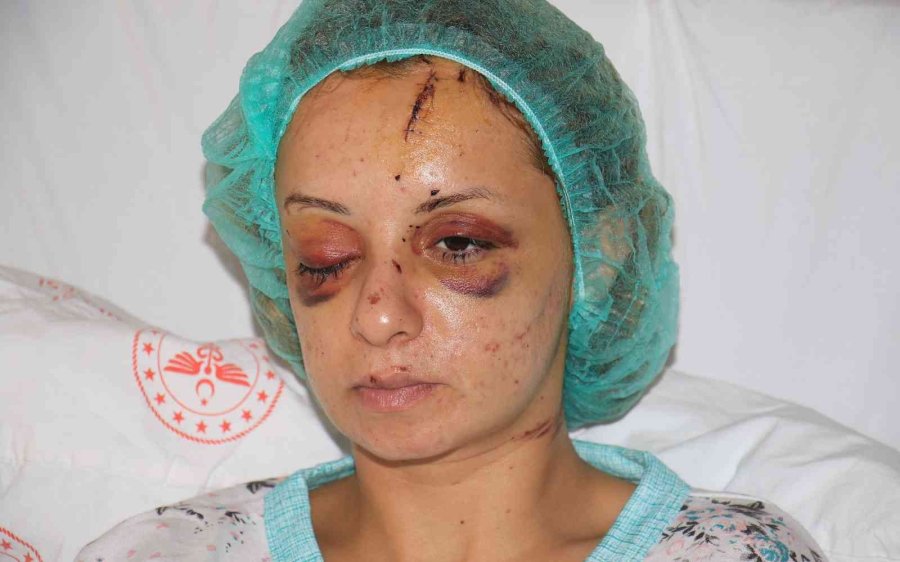 Yoğun Bakımdan Çıkan Kadın, O Anları Anlattı