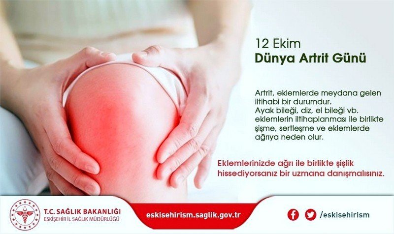 Sağlık Müdürü Bilge’den "dünya Artrit Günü" Mesajı
