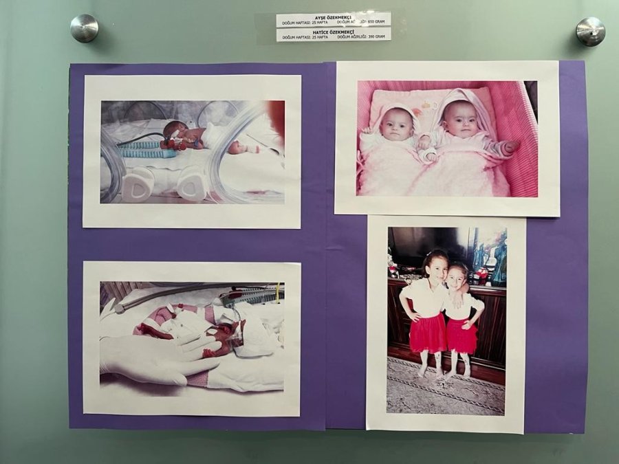 Prematüre Bebeklerin İlk Ve Son Haline Ait Fotoğraflar Sergilendi