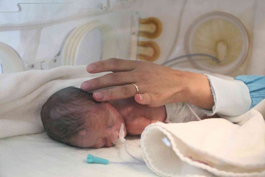 Antalya’da Turizmci Çifte 3’üz Bebek Şoku: "her Şeyi 3’le Çarptım, İki Hafta Kendime Gelemedim"