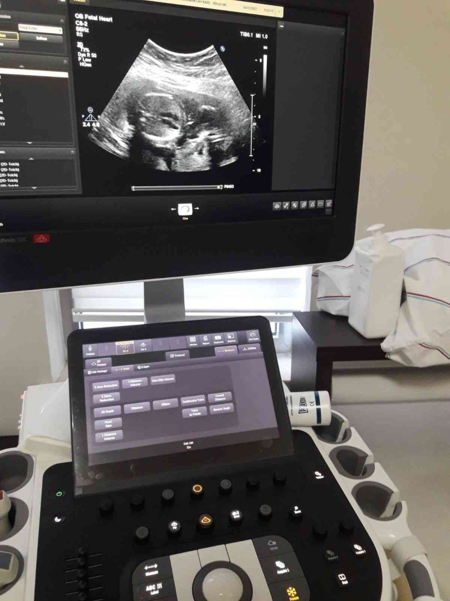 Karaman Eğitim Ve Araştırma Hastanesinde Fetal Ekokardiyografi Görüntüleme İşlemi Başladı