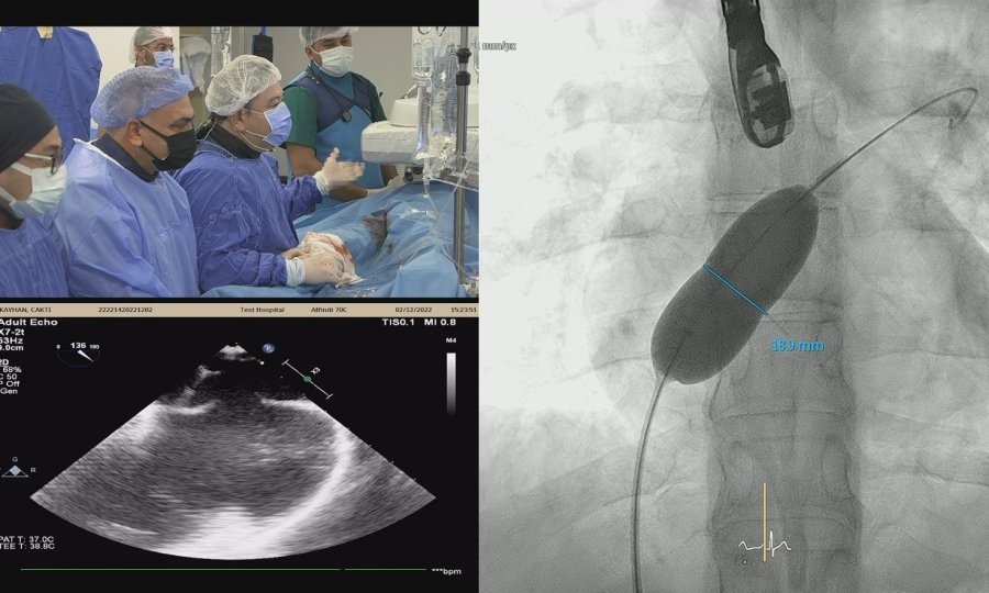 Kardiyolojinin Kalbi Akdeniz Üniversitesi’nde Attı