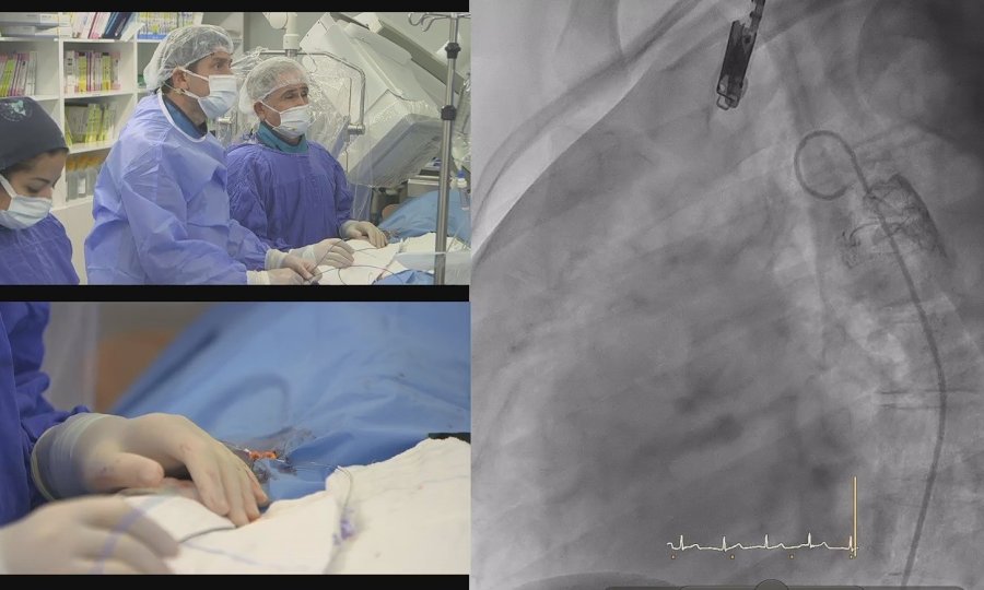 Kardiyolojinin Kalbi Akdeniz Üniversitesi’nde Attı