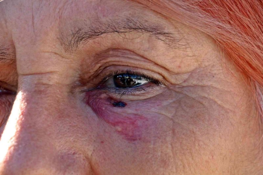 Antalya’da Ev Sahibi İle Kiracının Kavgası Güvenlik Kamerasına Yansıdı