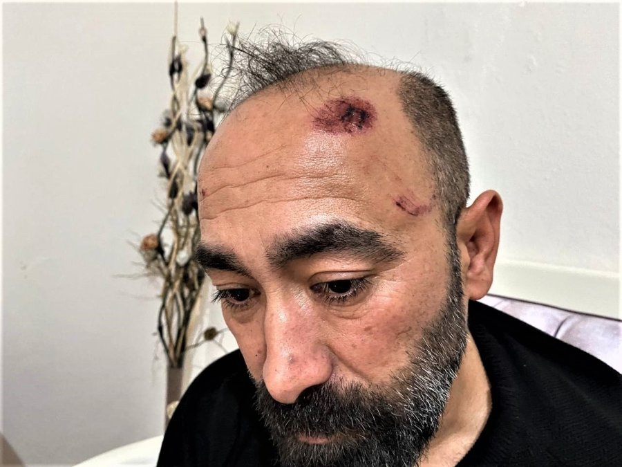 Müşterinin Kaldırım Taşı İle Dehşeti Yaşattığı Taksici: "kaç Defa Vurdu Sayamadım"