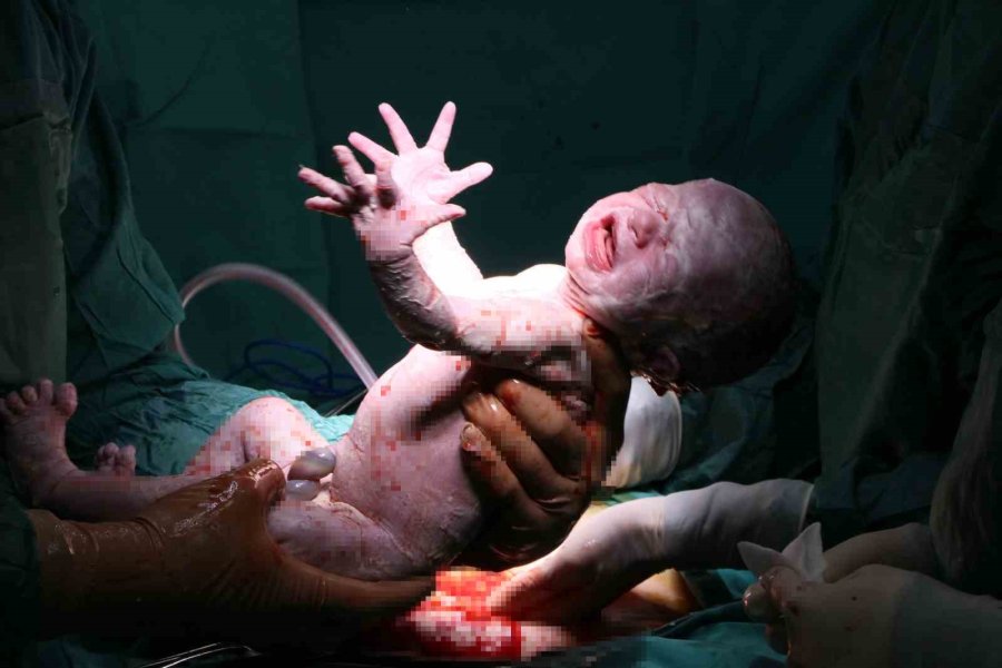 Enkazdan Çıkan Çift 4 Yıldır Bekledikleri Bebeklerine Mersin’de Kavuştu