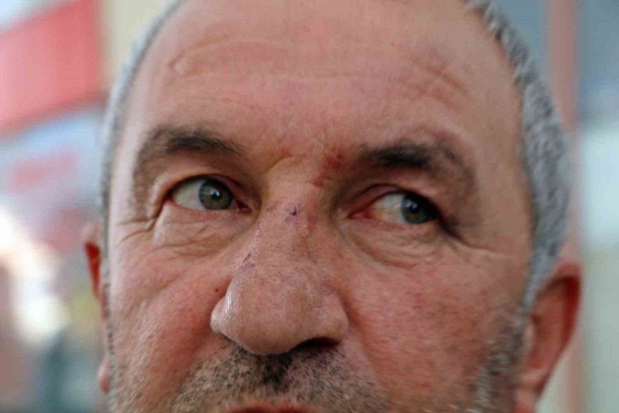 Kulak Zarını Patlatana Kadar Dövdüler, ‘bu Değilmiş’ Deyip Gittiler