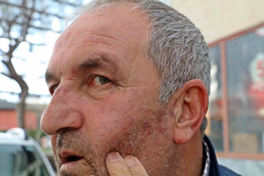 Kulak Zarını Patlatana Kadar Dövdüler, ‘bu Değilmiş’ Deyip Gittiler