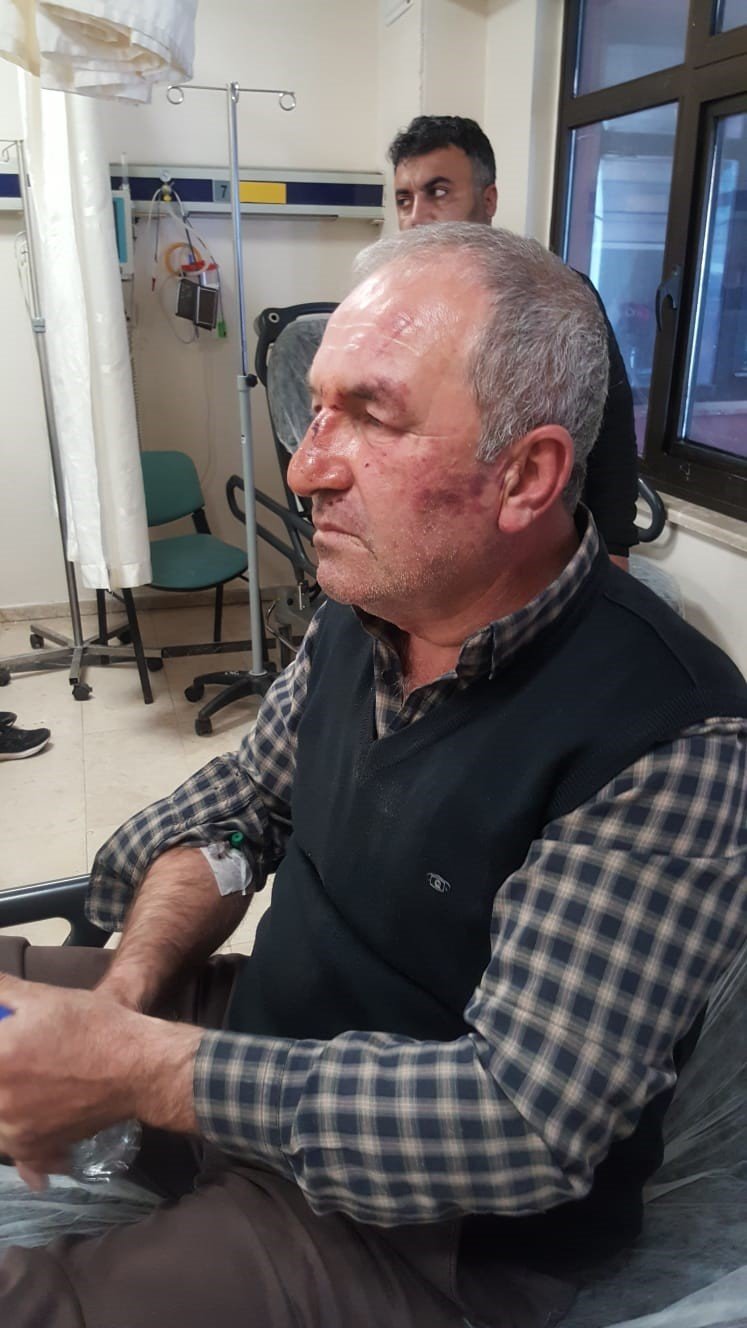 Kulak Zarını Patlatana Kadar Dövdüler, ‘bu Değilmiş’ Deyip Gittiler