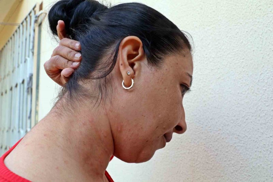 Evinin Bahçesindeki Tırtılları Süpürdü, Hastanelik Oldu