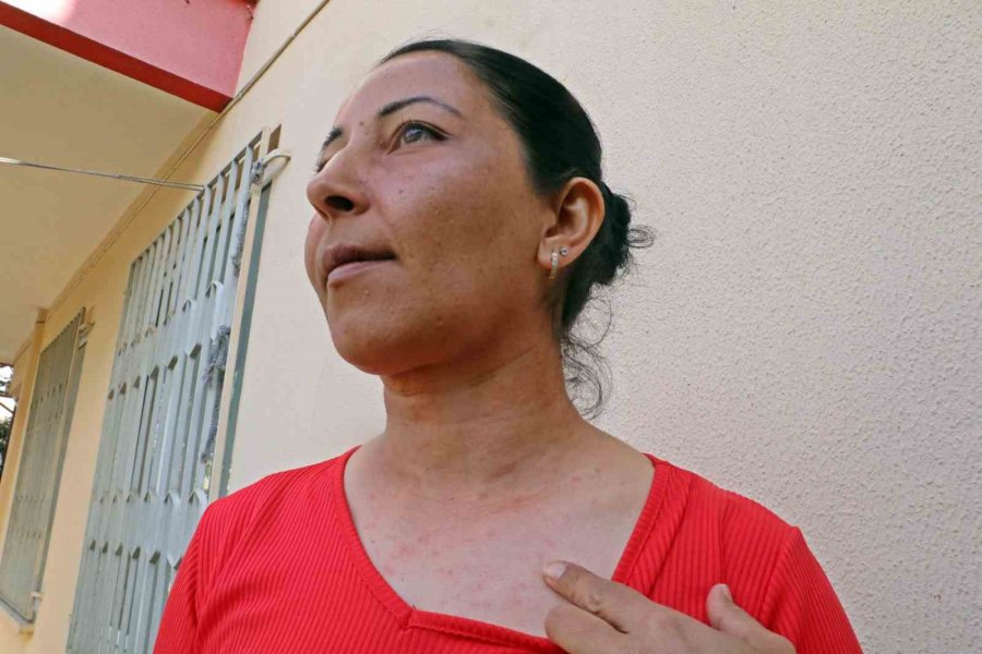 Evinin Bahçesindeki Tırtılları Süpürdü, Hastanelik Oldu