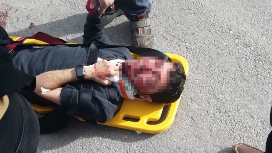 Motosikletler Kafa Kafaya Çarpıştı: 3 Yaralı