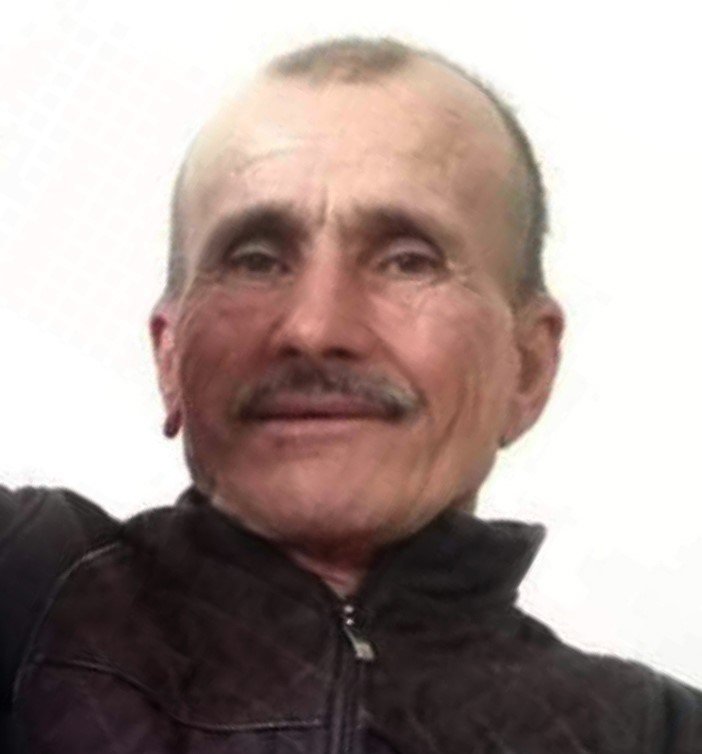 Otomobil İle Elektrikli Motosiklet Çarpıştı: 1 Ölü