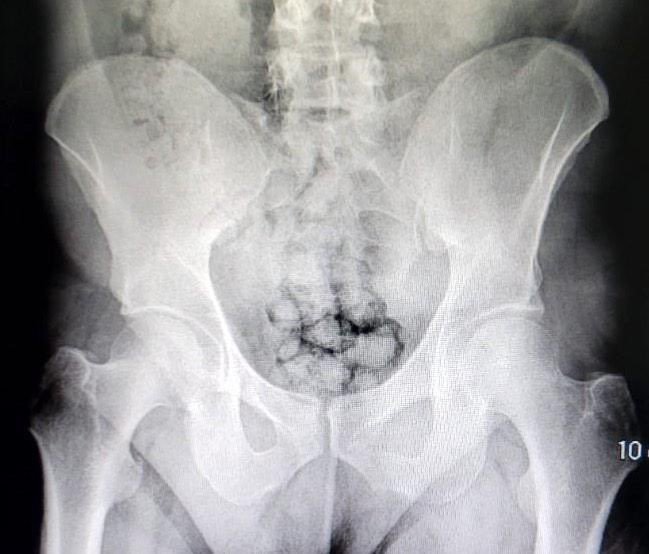 Midelerinde Uyuşturucu Ticareti Yapan Şahıslar Adliyede