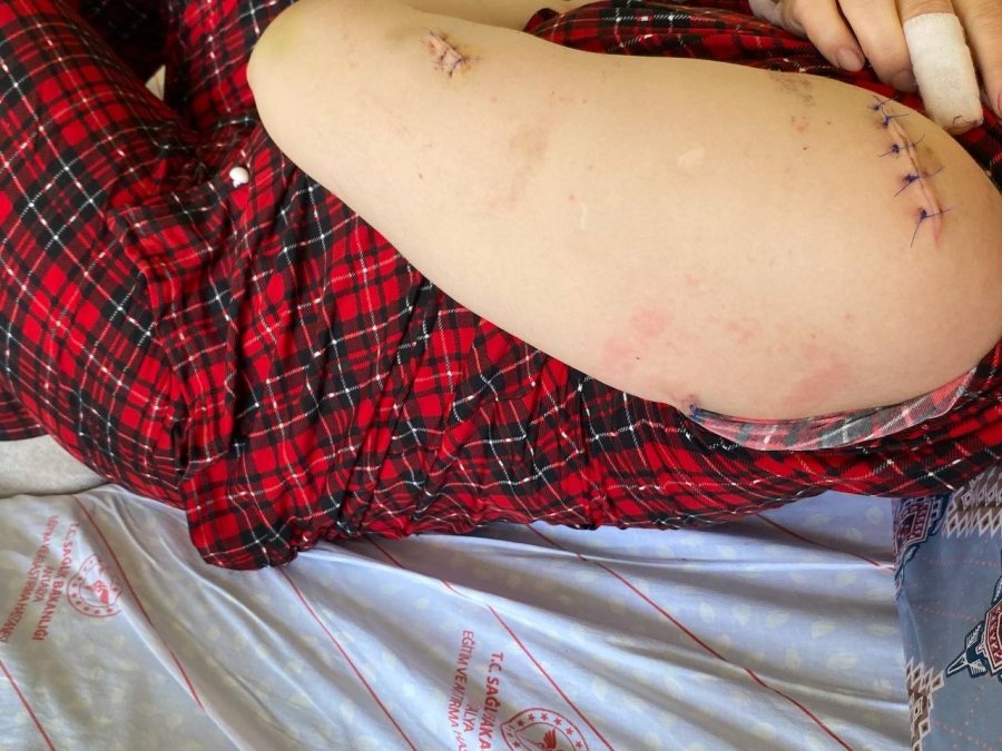 Evin Elektriğini Kesip Kapıyı Açtıran Eşi Tarafından 24 Yerinden Bıçaklandığı Anları Gözyaşları İçinde Anlattı