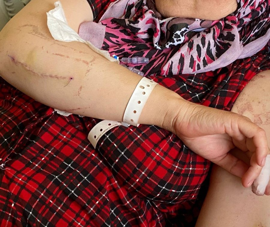 Evin Elektriğini Kesip Kapıyı Açtıran Eşi Tarafından 24 Yerinden Bıçaklandığı Anları Gözyaşları İçinde Anlattı