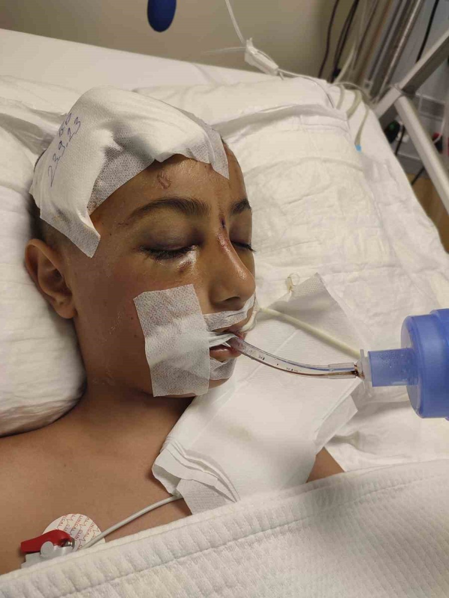 Okula İlk Kez Bisikletle Gitmek İstedi, Ölümden Döndü