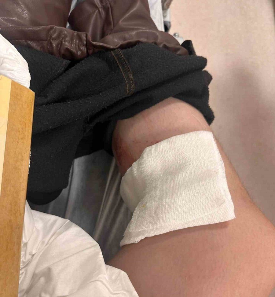 Konya’da Ziraat Mühendisi Kadın, Sokak Köpeğinin Saldırısında Yaralandı