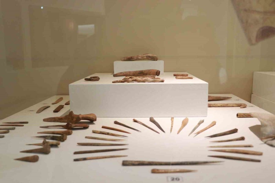 Dünyanın İlk Beyin Ameliyatına Ait Kafatası