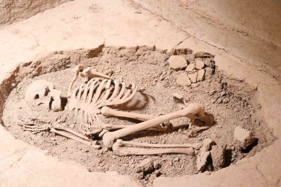 Dünyanın İlk Beyin Ameliyatına Ait Kafatası