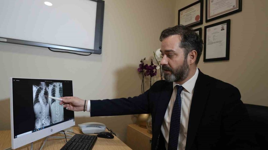 Skolyozun Belirlenmesinde Ailelere Büyük Görev Düşüyor