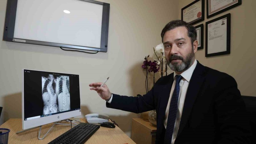 Skolyozun Belirlenmesinde Ailelere Büyük Görev Düşüyor