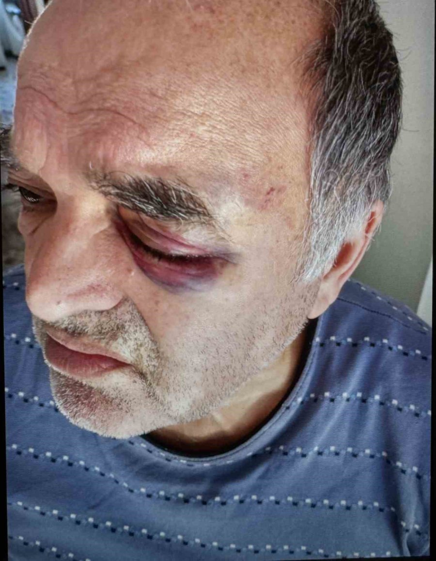 Okul Müdürünün Darp Ettiği Çift İha’ya Konuştu