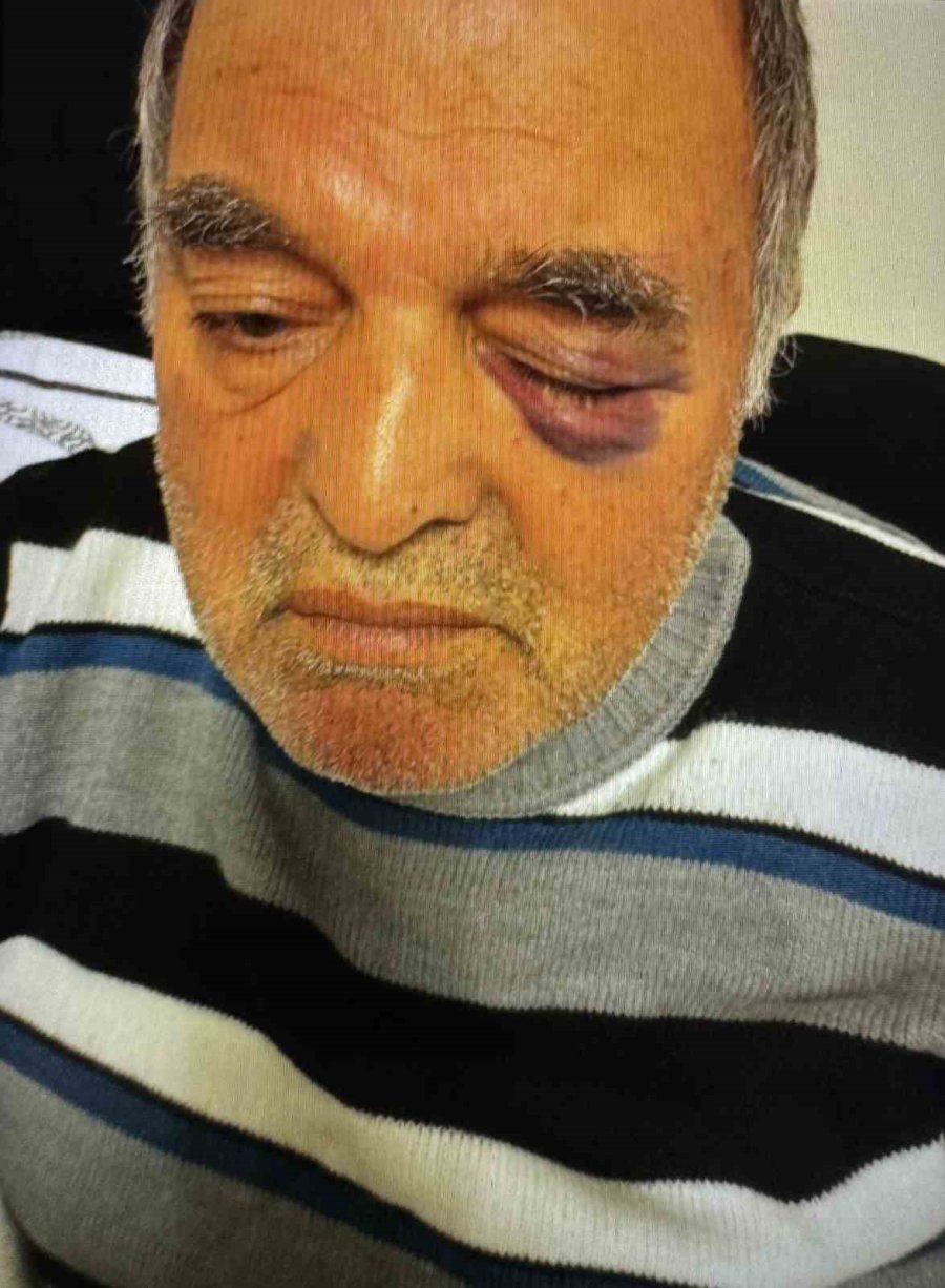 Okul Müdürünün Darp Ettiği Çift İha’ya Konuştu