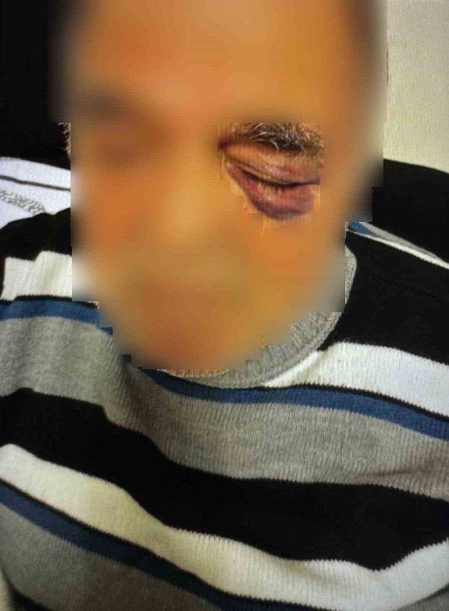 Yaşlı Çiftin Darp Edilmesiyle İlgili Yeni Gelişme: Müdürün Oğlu Da Tutuklandı