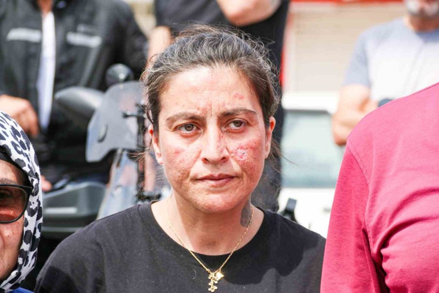 Antalya’da 19 Yaşındaki Genci Hayattan Koparan Kazayla İlgili Vahim İddia: “yarış Yapıyorlardı”